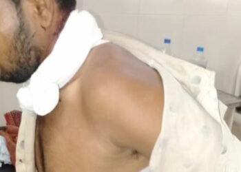 अमळनेर..!  रेल्वे स्थानकावर चोरट्यांचा तरुणावर प्राणघातकत हल्ला