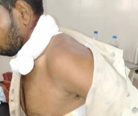 अमळनेर..!  रेल्वे स्थानकावर चोरट्यांचा तरुणावर प्राणघातकत हल्ला