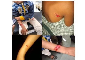 अमळनेर: पिसाळलेल्या कुत्र्यांचा १३ जणांना चावा; नागरिकांमध्ये भीतीचे वातावरण