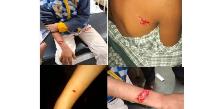 अमळनेर: पिसाळलेल्या कुत्र्यांचा १३ जणांना चावा; नागरिकांमध्ये भीतीचे वातावरण